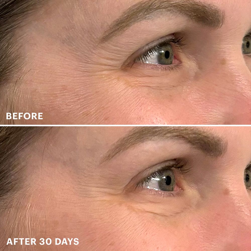 Bio-Renew EGF Eye Cream